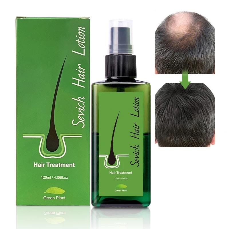 Thai Natural Hair Regrowth Spray 120ML - Hair Care - by Sevich Factory ...